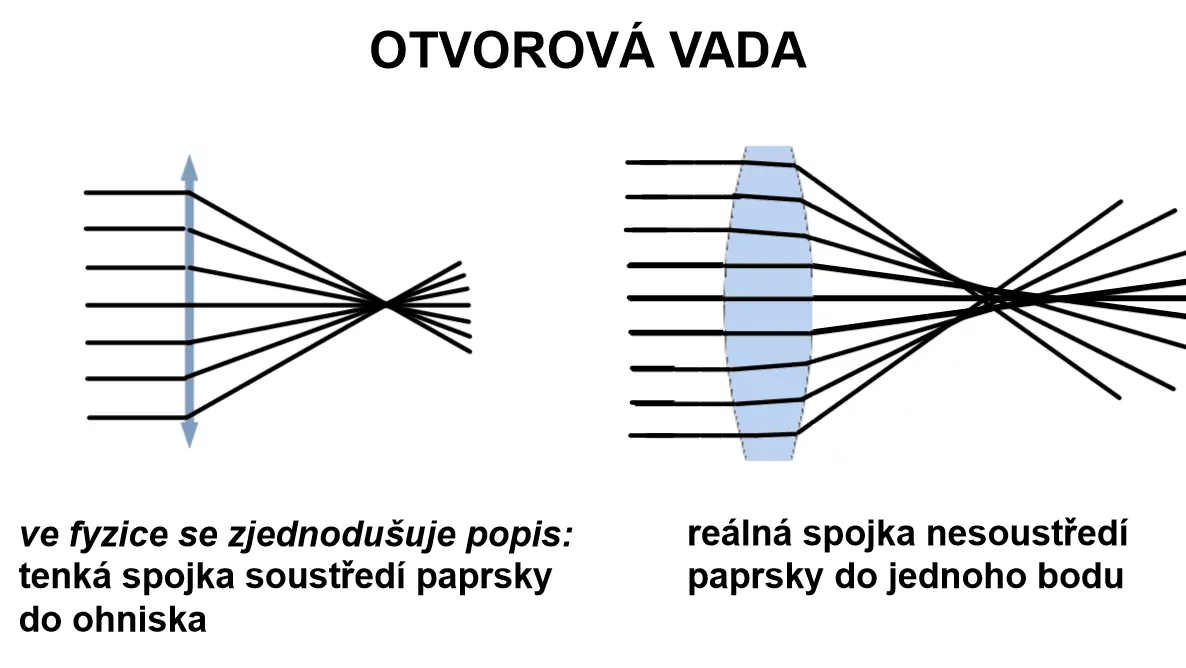 Otvorová vada